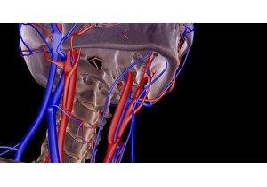 МРТ артерий шеи с контрастным усилением: динамическим контрастированием (контрастной перфузией) в объеме 20 мл