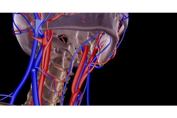МРТ артерий шеи с контрастным усилением: динамическим контрастированием (контрастной перфузией) в объеме 20 мл