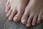 Обработка инфицированной/утолщенной ногтевой пластины (маленький ноготь)